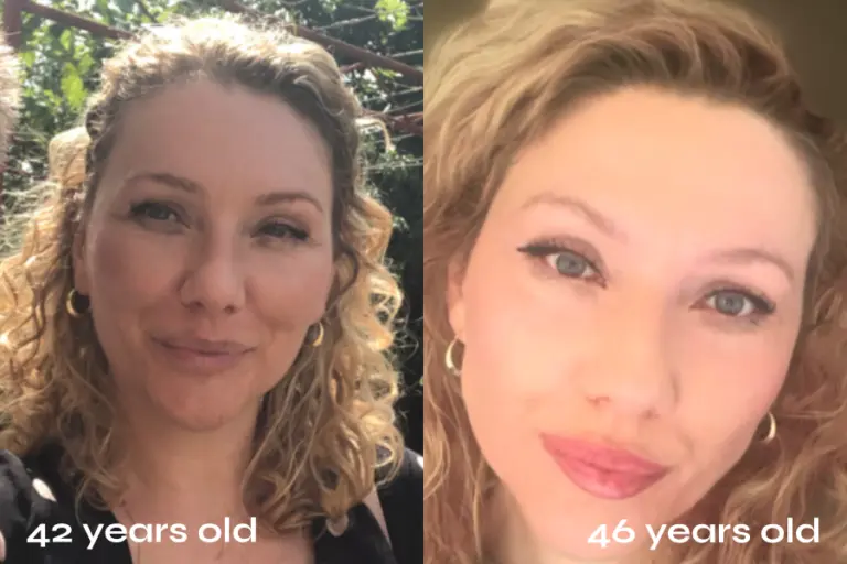 Dubravka before after 2